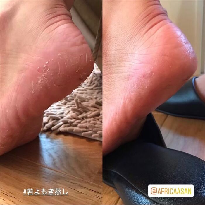 画像1410