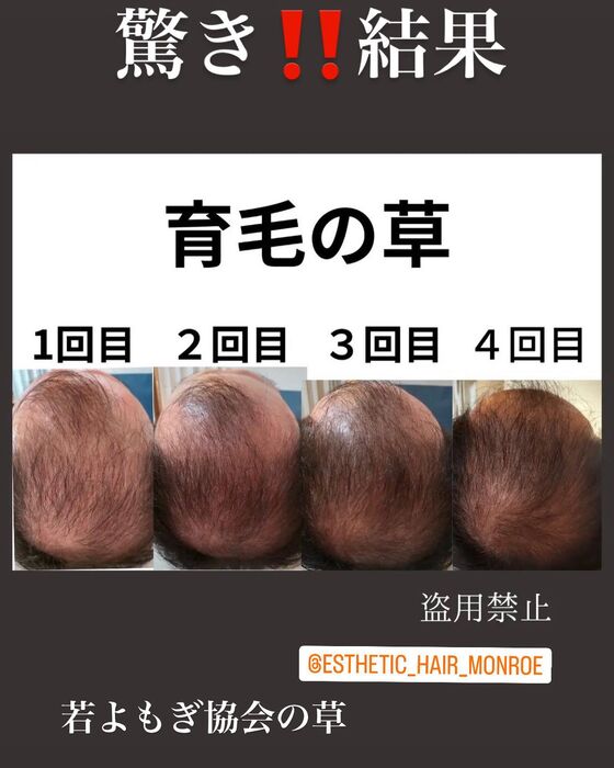 画像1497