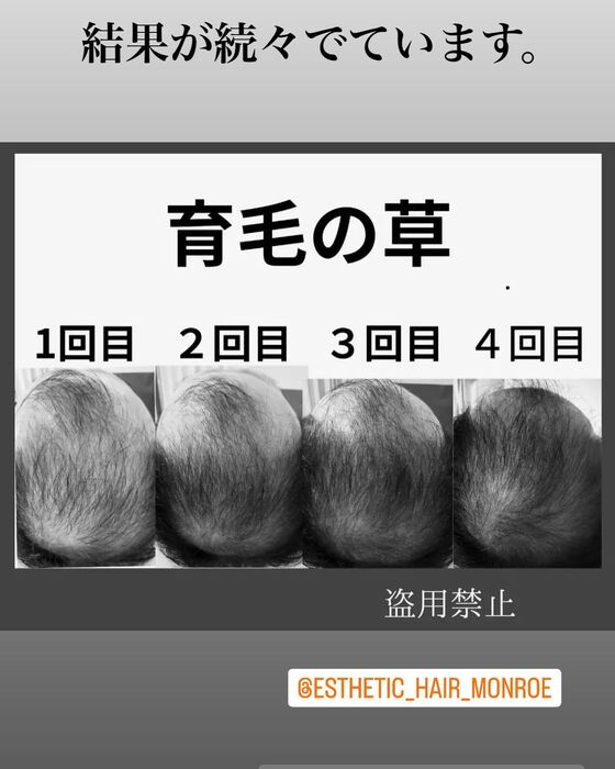 画像1498